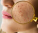 Common Skin Issues 1