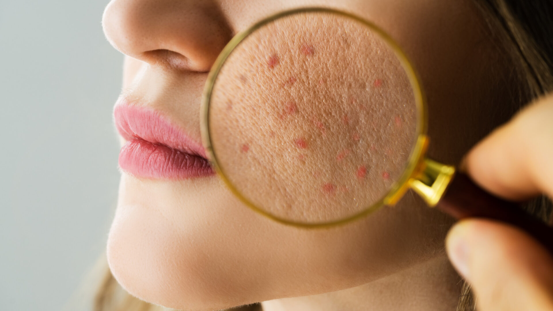 Common Skin Issues 1
