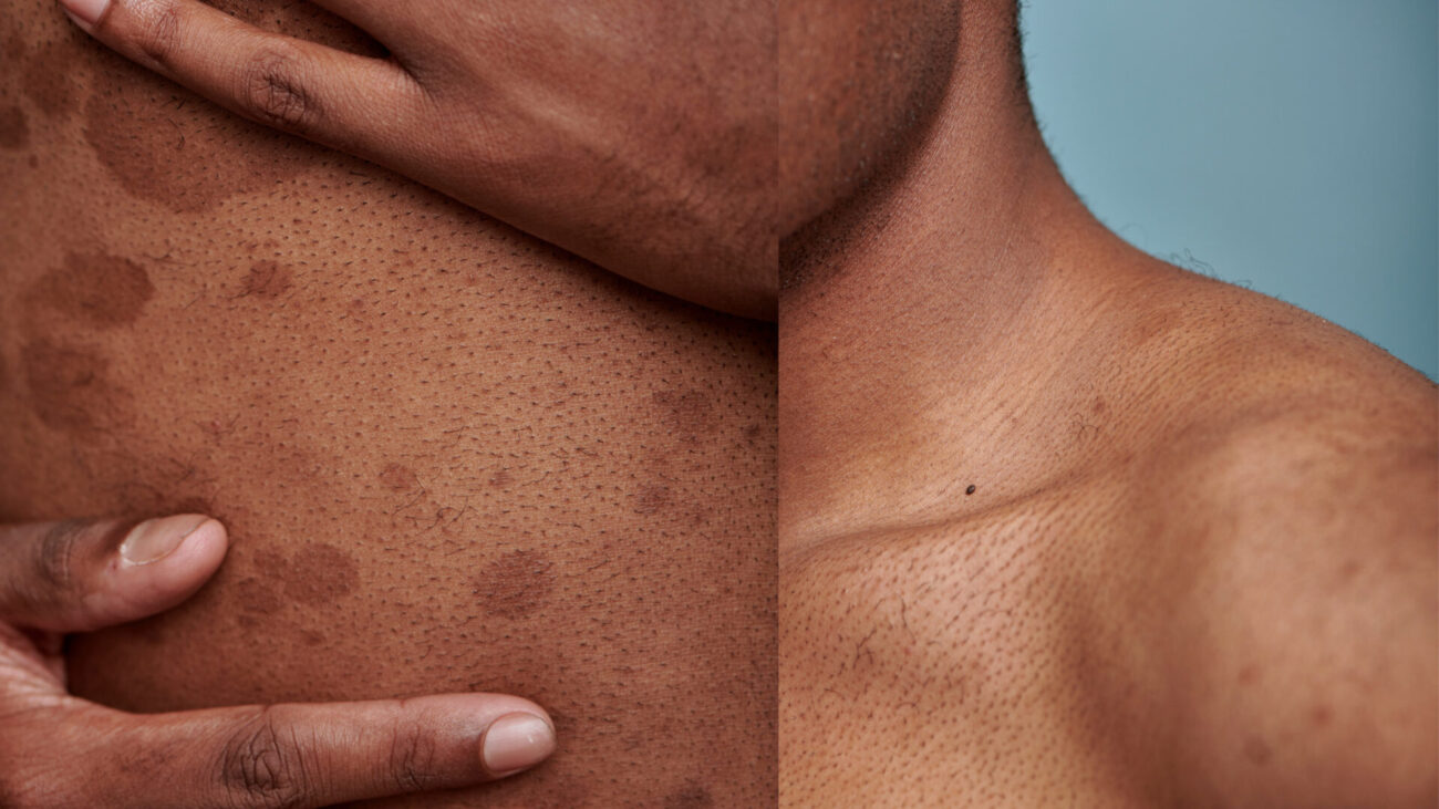 Common Skin Issues 3